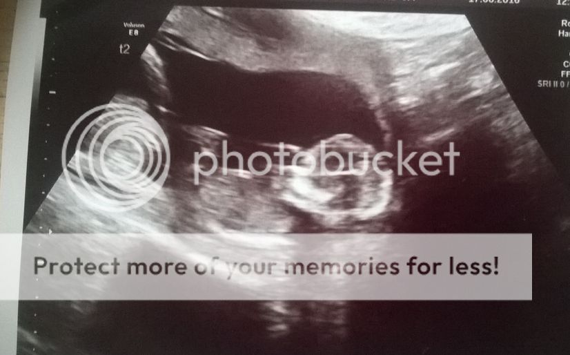 When will i have my dating scan uk